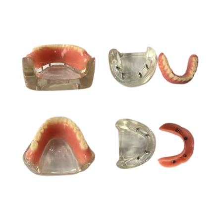 Model - proteza całkowita na zaczepach kulowych 4`