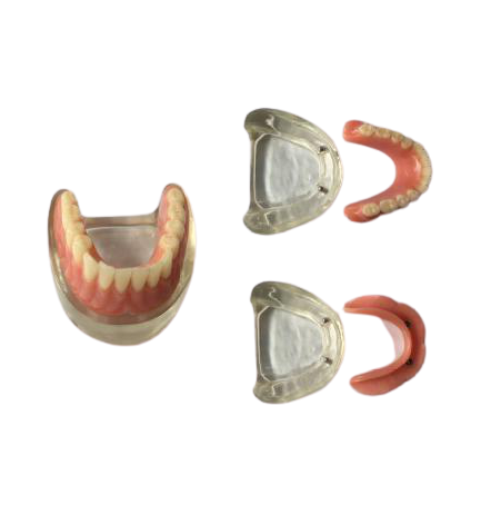 Model - proteza całkowita na zaczepach kulowych 2`