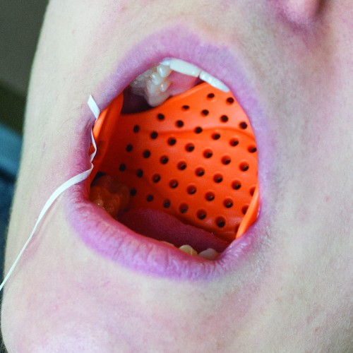 BLOKADA do języka: AIR Armor zestaw