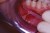 Myzotect-Tincture-CL-01.jpg