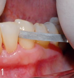 Paski z nasypem diamentowym ProxoPolish 15/08 mq; 6 szt.