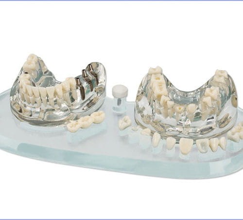 Model,zapasowy zestaw wymiennych prac (11 sztuk)