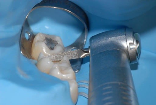 Pilnik oscylacyjny Proxoshape PS0, nasyp 125 mq, 1szt.