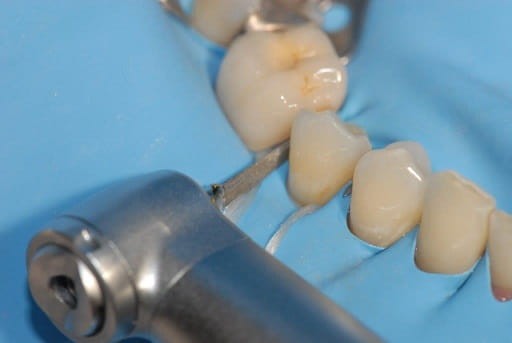 Pilnik oscylacyjny Proxoshape PS0, nasyp 125 mq, 1szt.