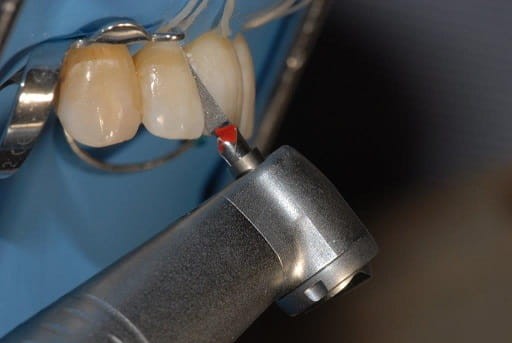 Pilnik oscylacyjny Proxoshape PSF60, nasyp 60 mq, 1 szt.