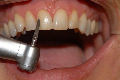 Pilnik oscylacyjny Proxoshape PSF60, nasyp 60 mq, 1 szt.