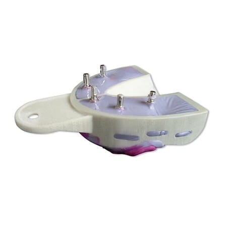 Łyżki do implantów 6 szt.- Miratray Implant żuchwa nr 1(I-1)