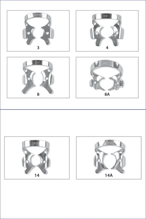 Klamra 3 na trzonowce, poddziąsłowa ze skrzydełkami