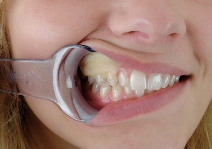 Opatrunek chirurgiczny Reso-Pac, tubka 25g