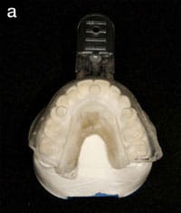Łyżki do rejestracji, AXI PATH 10 szt.PANADENT®